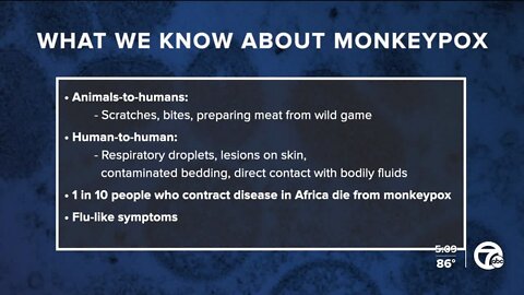 Dr. Nandi breaks down what you need to know about rare monkeypox virus