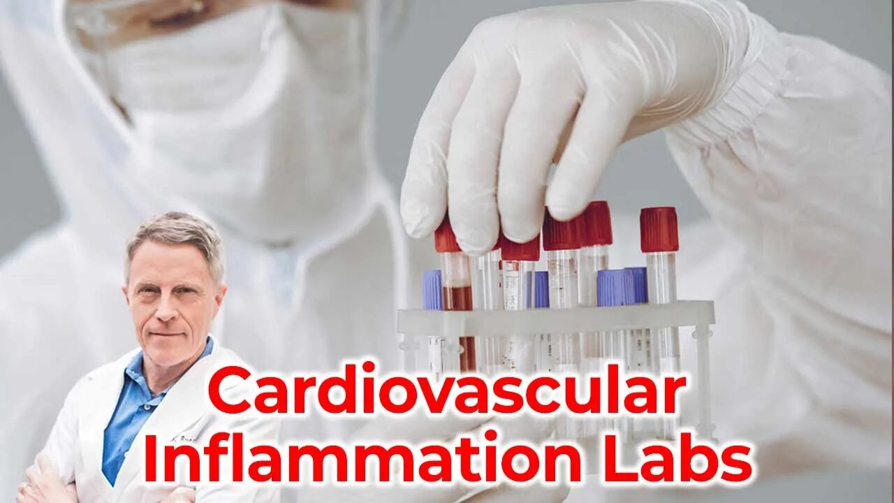 CV Inflammation Labs