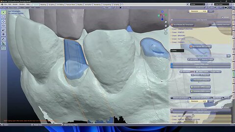 Making post cores with the B4D Crown Module