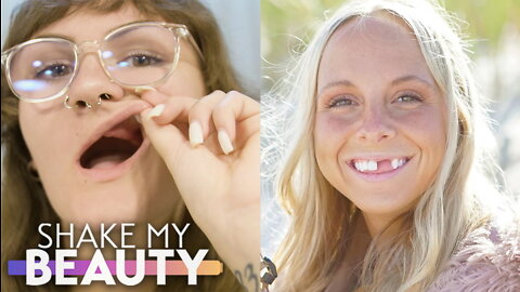 We Lost Our Teeth - Not Our Smile | SHAKE MY BEAUTY