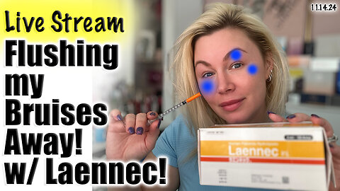 Live Bruise Flushing with Laennec, AceCosm.com |Wannabe Beauty Guru| Code Jessica10 saves you Money