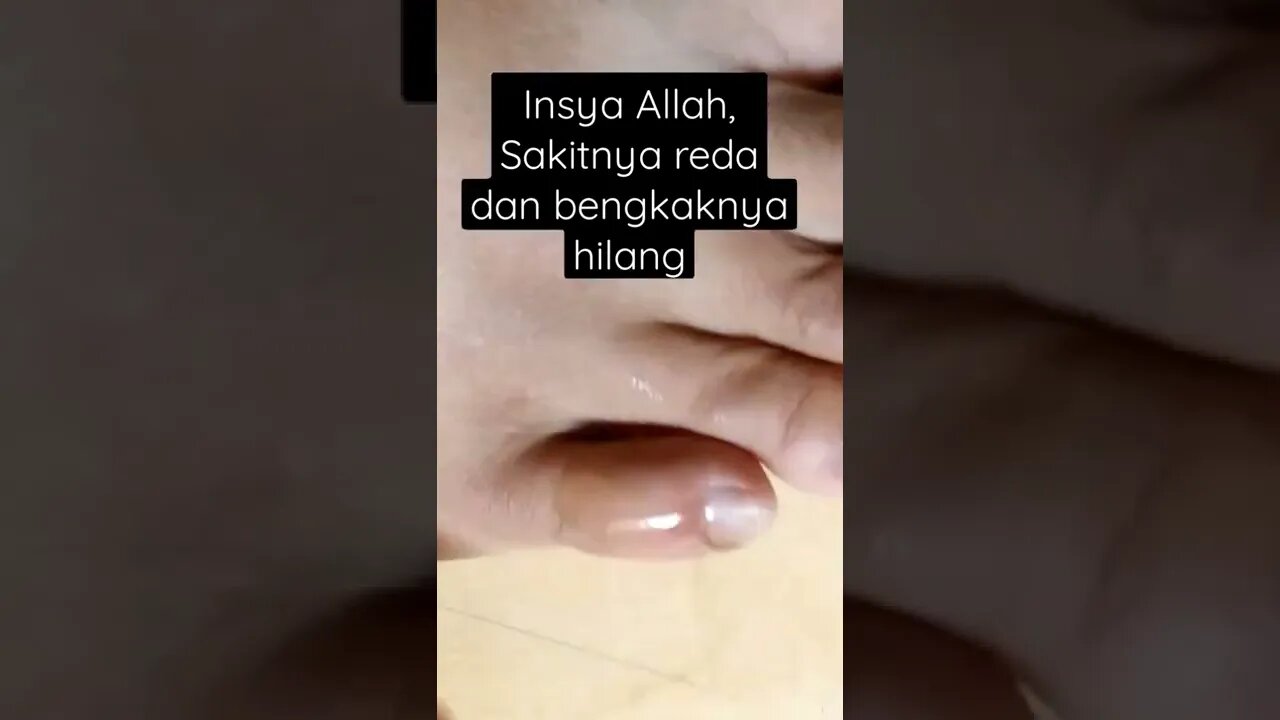 obat bengkak minyak gosok cap beruang