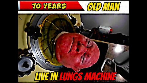 70 Year old Man in Lungs Machine .😱