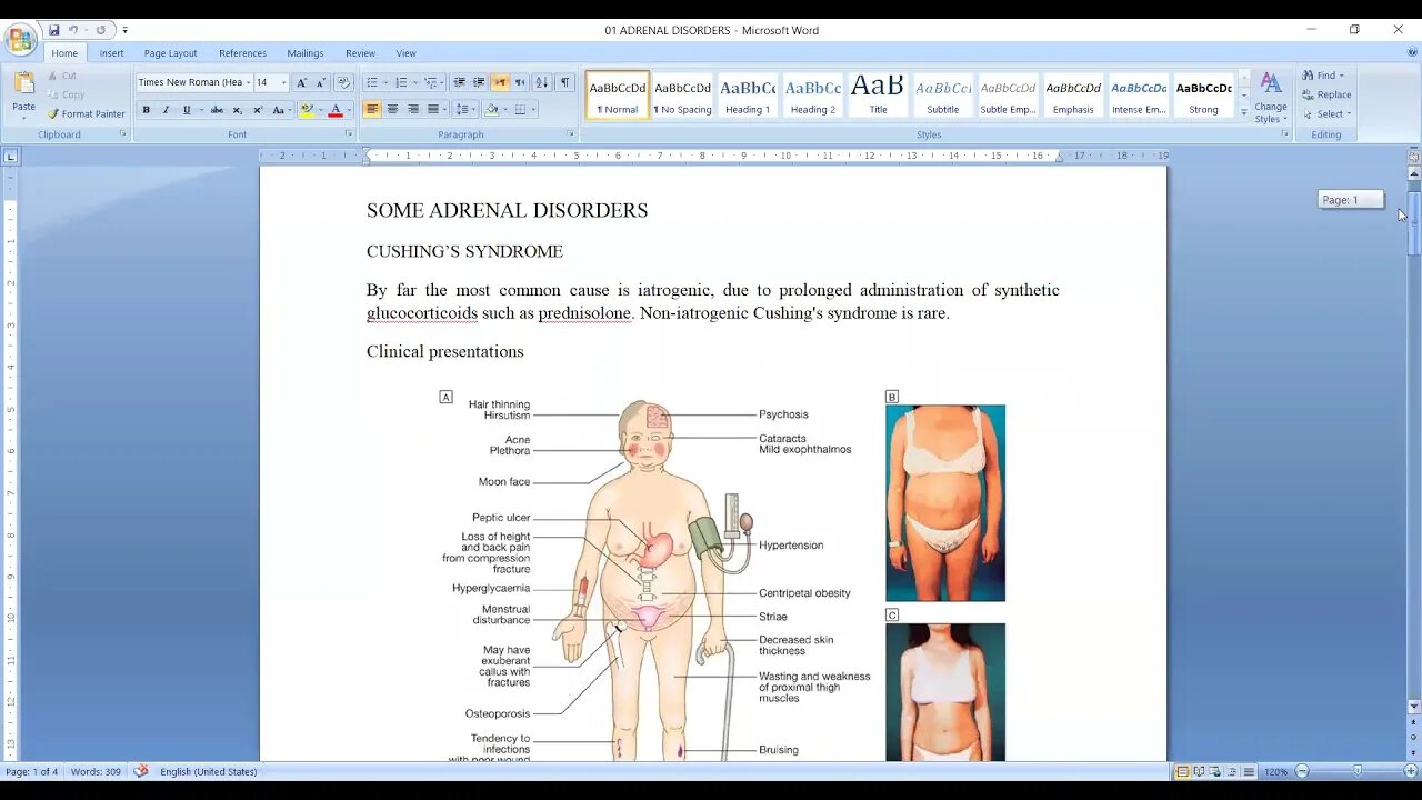 General medicine L16 (Adrenal disorders)