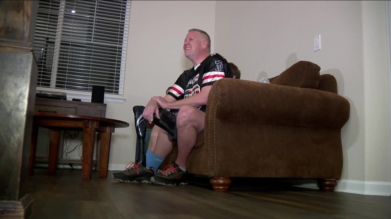 Castle Rock woodworker known for charity work shares life lesson after losing leg