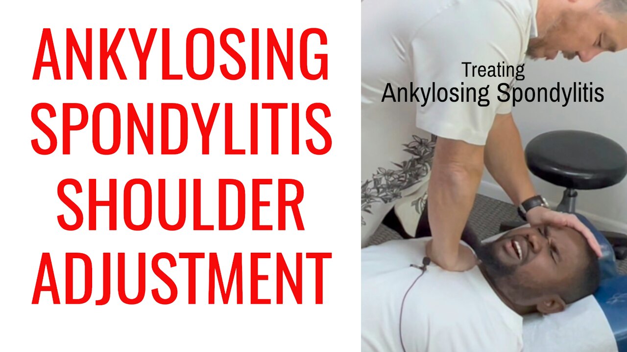 Ankylosing Spondylitis Shoulder Adjustment by Chiropractor