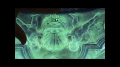 Sitting Frog Giving Birth - Jonathan Kleck