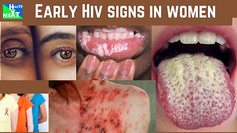 EARLY SIGNS OF HIV IN WOMEN
