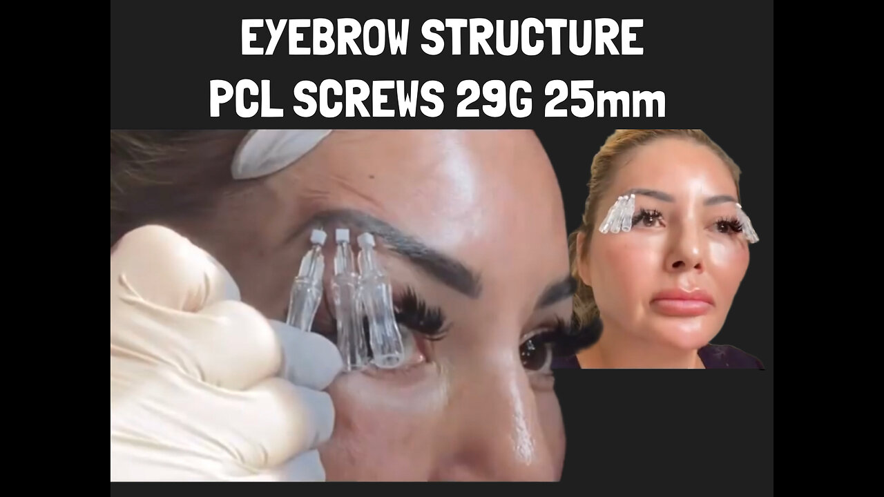 Eyebrow Lift and Rejuvenate