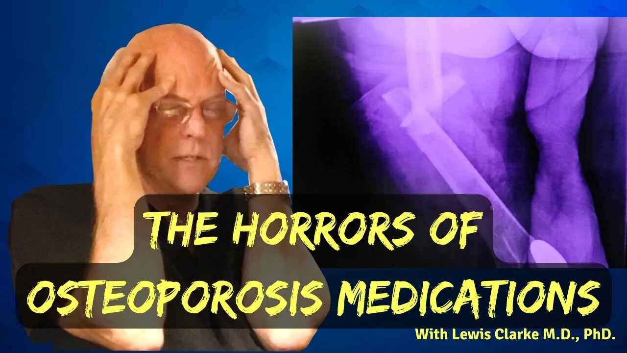 What They Aren't Telling You About Osteoporosis Medication