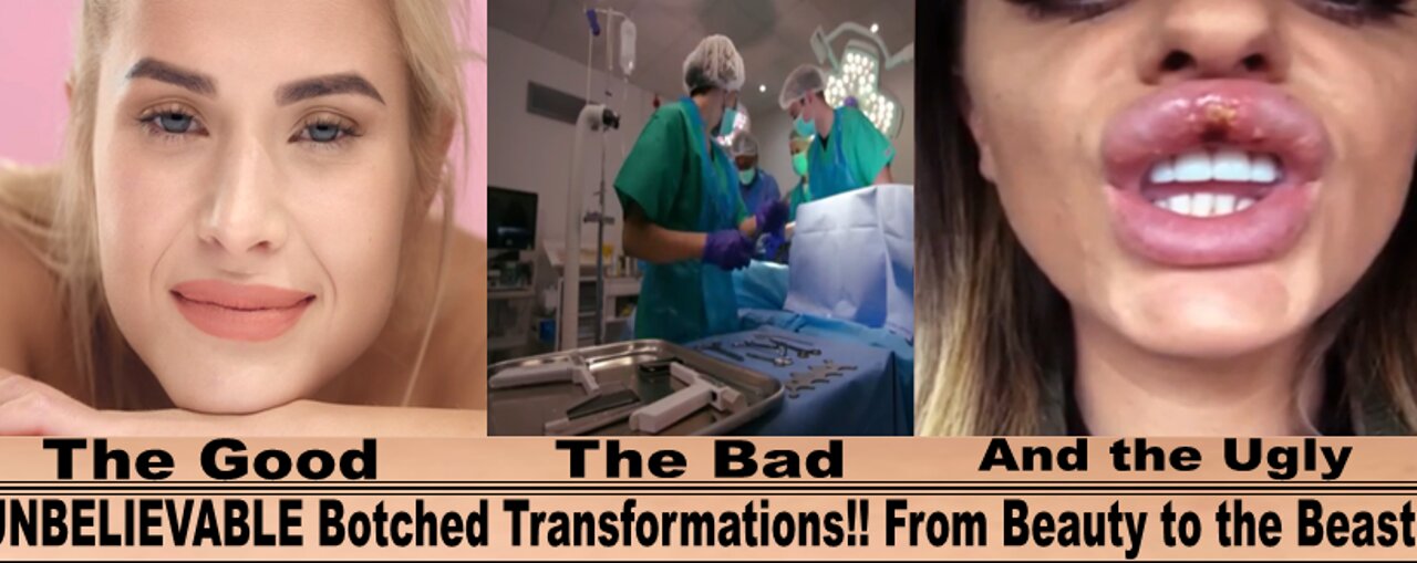 Most fatal cosmetic surgery II THE GOOD THE BAD AND THE UGLY