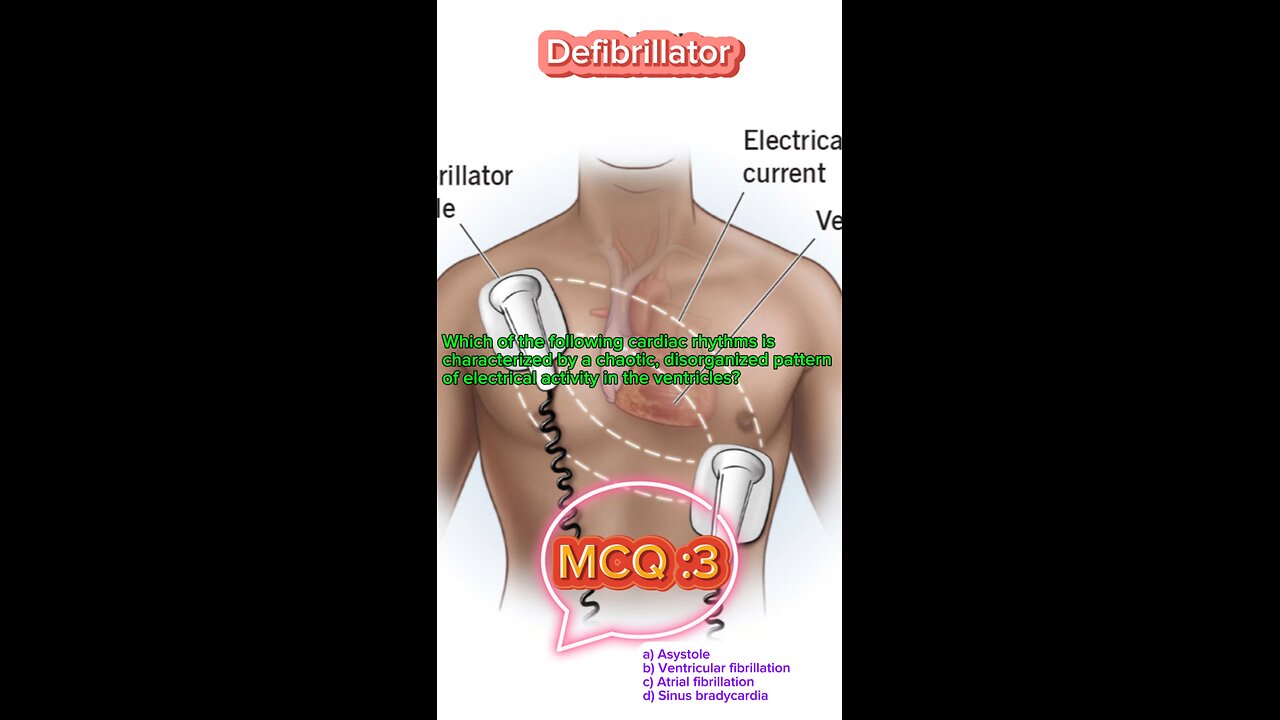 Defibrillator machine in icu #defibrillator #mcqs #pharmacologynotes #MedicalQuiz #mcqs #quiz