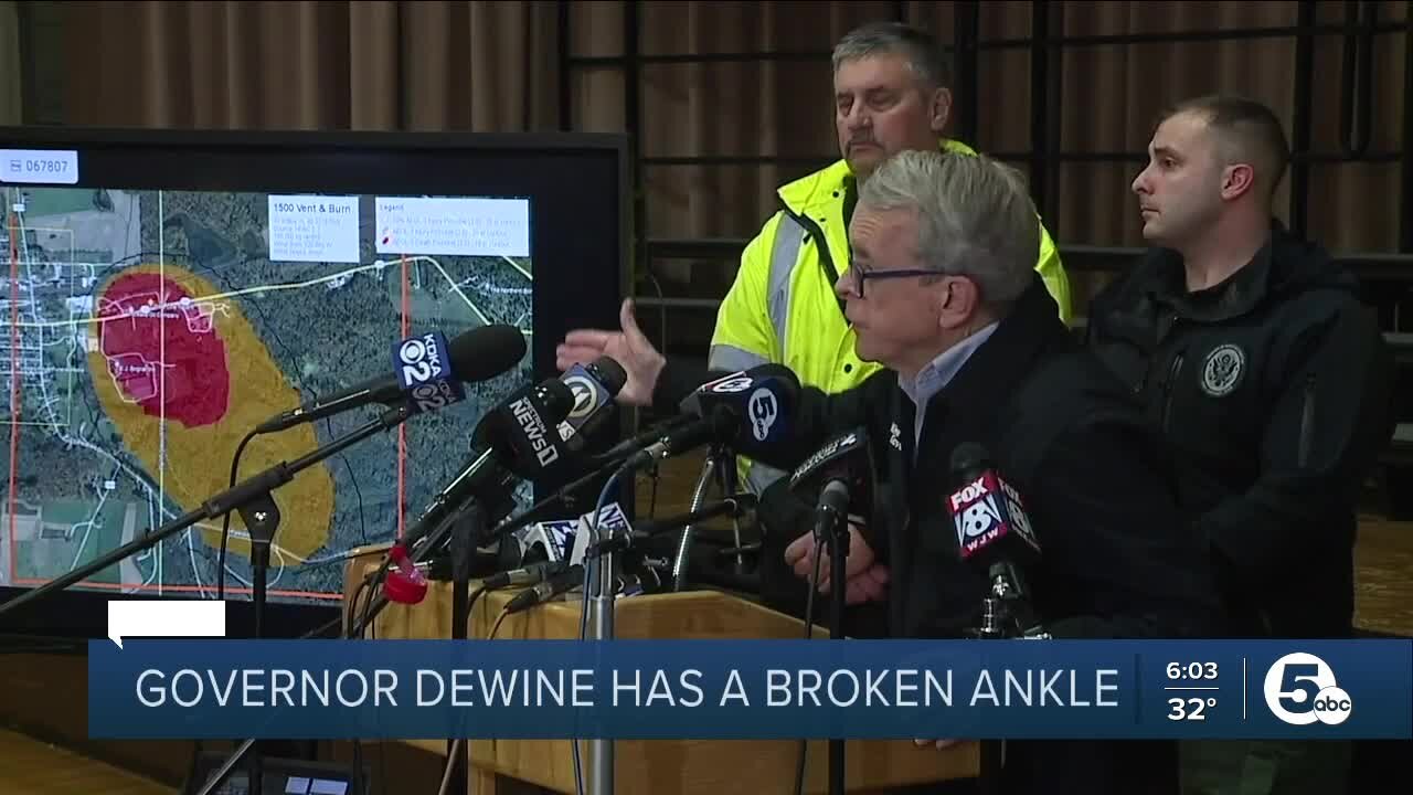 'I'm fine': Gov. DeWine says injury will not impact his work