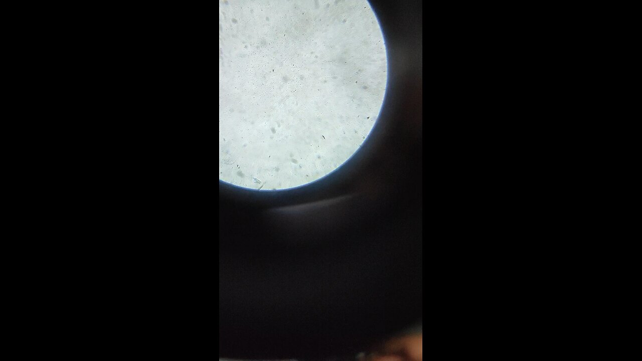 under microscope tap water