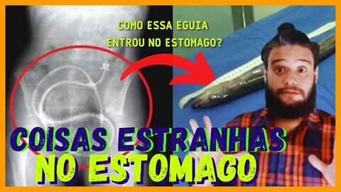 10 COISAS ESTRANHAS ENCONTRADOS DENTRO DO CORPO #curiosidades #vocesabia #historia #corpo #shorts