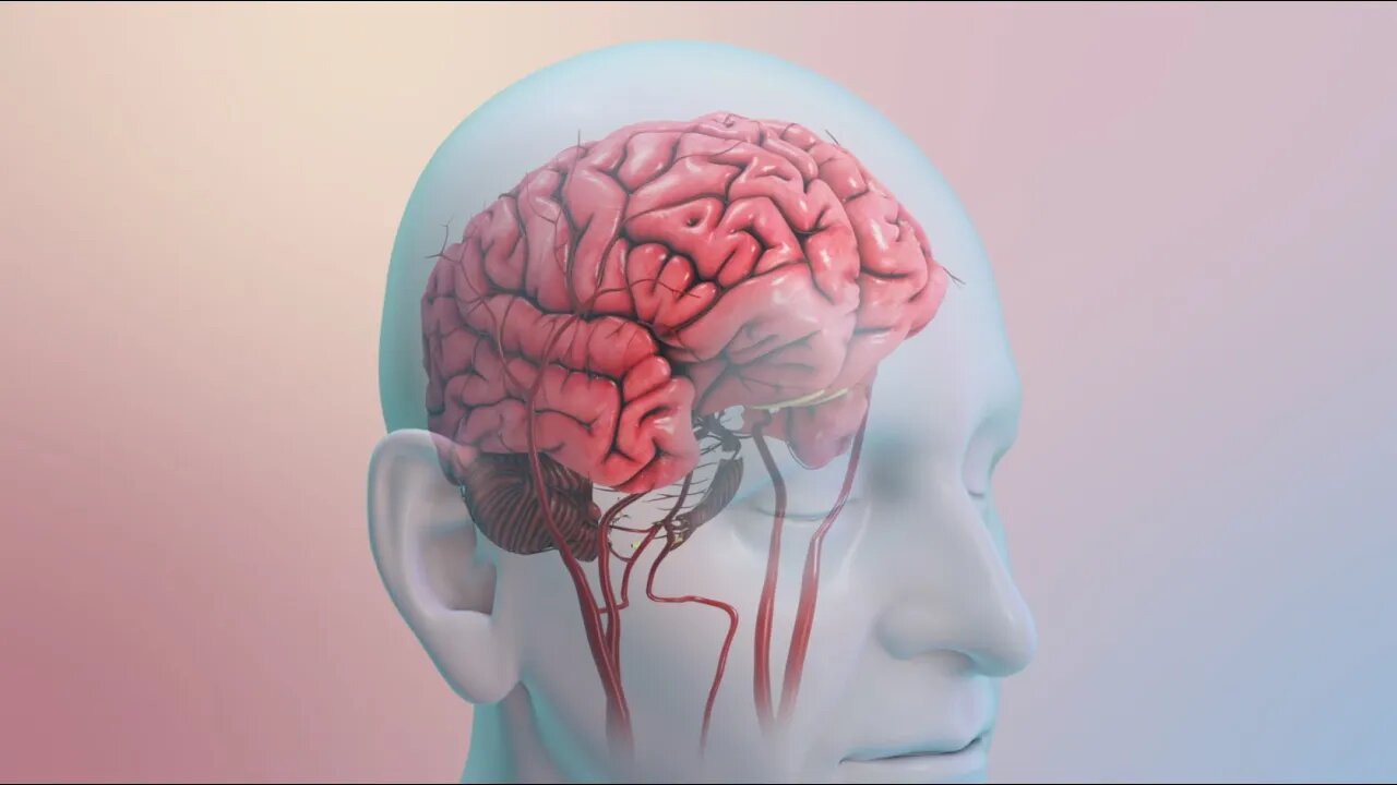 Su riesgo de sufrir un accidente cerebrovascular