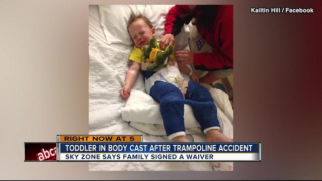 3YO in body cast after trampoline accident