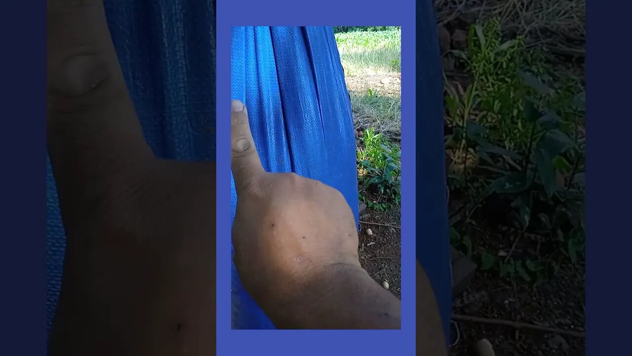 Como Dar Um Soco Sem Machuca as Mãos! Qual o Melhor Método Para Dar Um Soco?