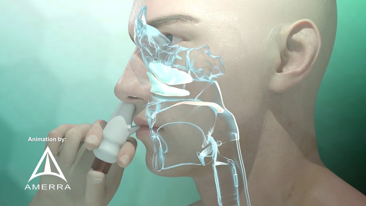 Fluticasone nasal spray (Flonase) - 3D medical animation