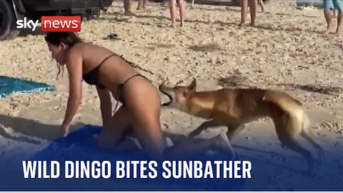 Australia Dog attack Girl