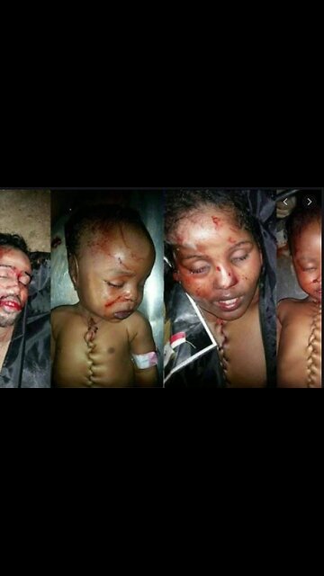 TI STA DICENDO CHE HA VISTO LA MACELLAZIONE DI BAMBINI E IL LORO PRELIEVO DI ORGANI