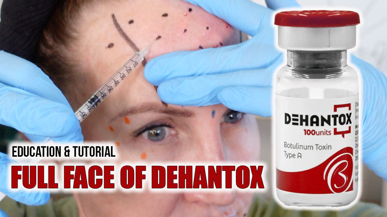 Full Face of Dehantox - Education & Tutorial #botox