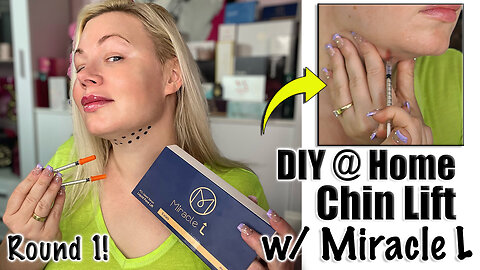 DIY Chin Lift with Miracle L: Round 1 from Acecosm.com | Code Jessica10 Saves you Money!