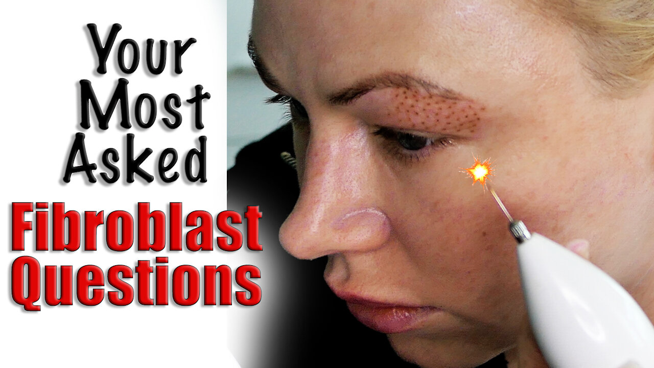 Your Most Asked Fibroblast questions | Wannabe Beauty Guru