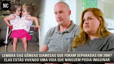 Lembra das gêmeas siamesas que foram separadas em 2006? Elas estão vivendo uma vida que ninguém