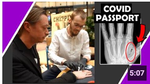 Sweden Start Putting Covid Passport Microchip In Hands #MarkOfTheBeast