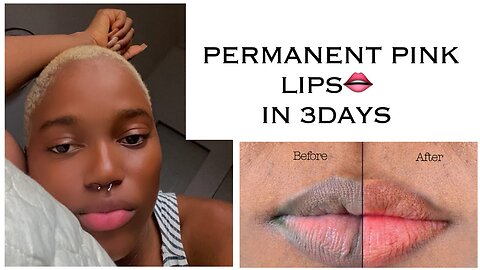 How To Get Pink Lips In 3 Days