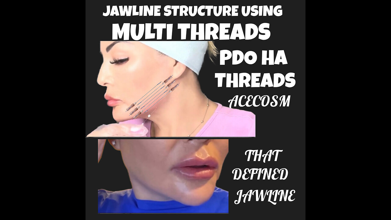 Jawline Contour
