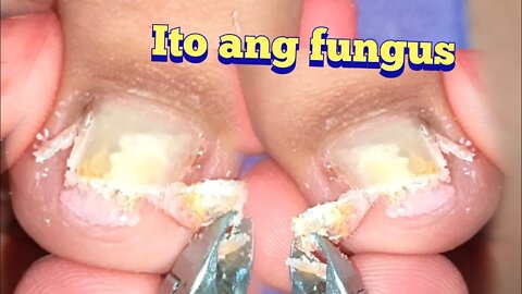 HOW TO PEDICURE A TOENAIL FUNGUS-RESTORATION PROCESS 🐾