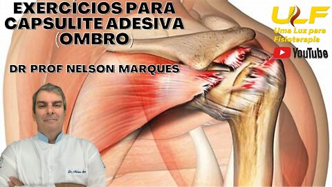 Exercícios para Capsulite Adesiva (Ombro) - Dr. Prof. Nelson Marques