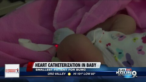 Smallest baby to receive heart catheterization at BUMC