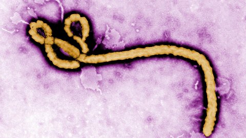 Deadly Ebola Outbreak In The Congo Surpasses 1,000 Cases