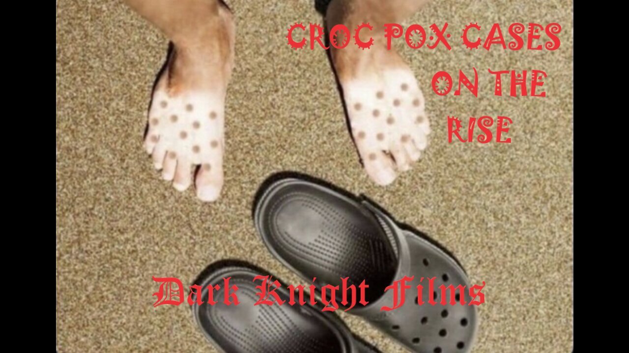 (Dark Knight) Tyson James - Monkeypox - feat Bryson Gray.