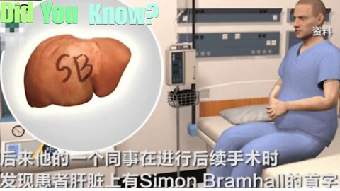 Did You Know? The Liver-Branding Surgeon || FACTS || TRIVIA