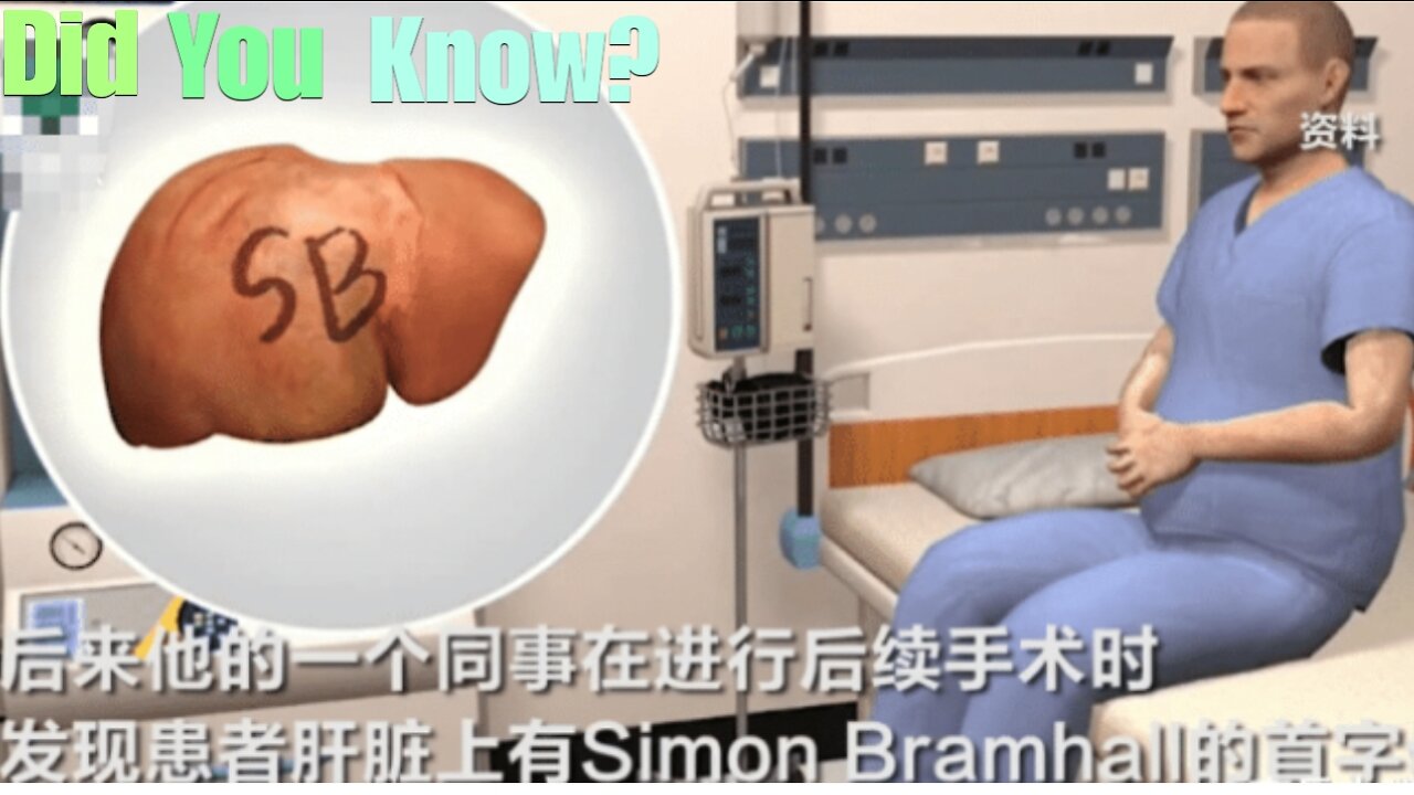 Did You Know? The Liver-Branding Surgeon || FACTS || TRIVIA