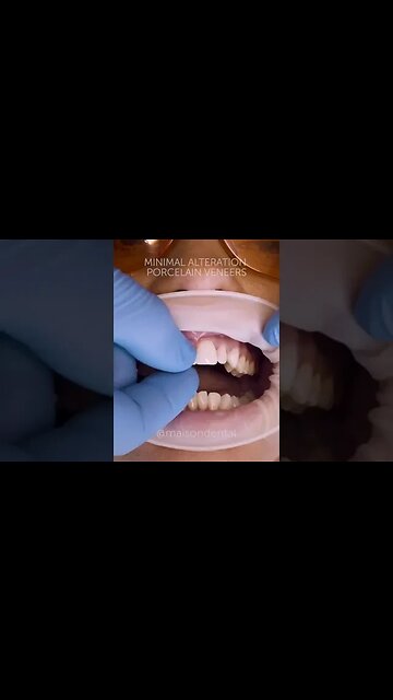 Dental And Teeth Hygiene