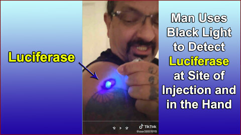 Black Light After Jab Reveals "Luciferase" MARK OF THE BEAST