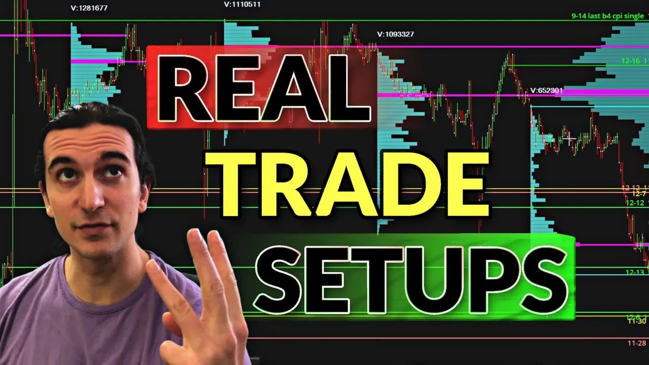 3 Day Trade Breakdowns | Bonds Order Flow Nuances