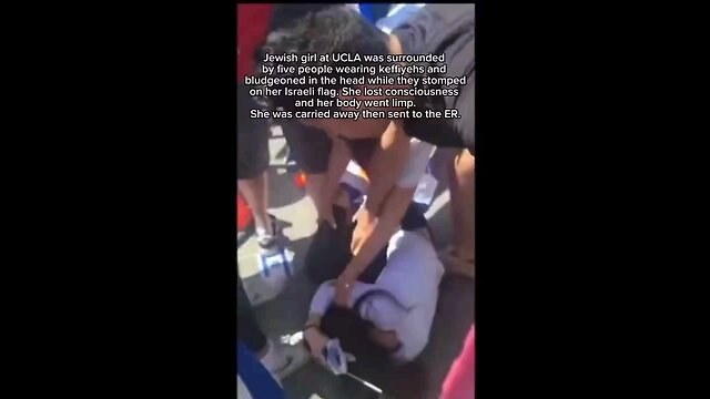 Pro Hamas rioters at UCLA beat Young Jewish girl unconscious. Rushed to the ER.