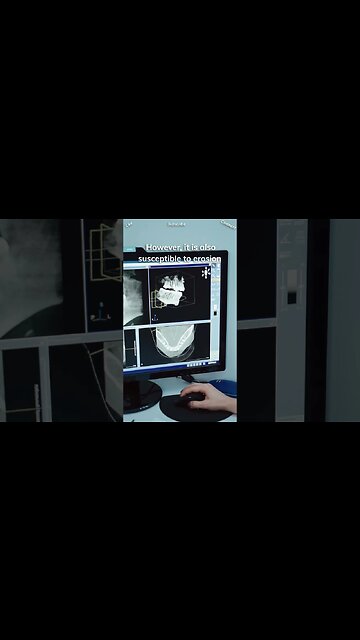 🦷 The human tooth enamel