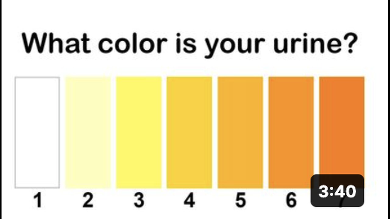 What The Color of Your Urine Says About Your Health