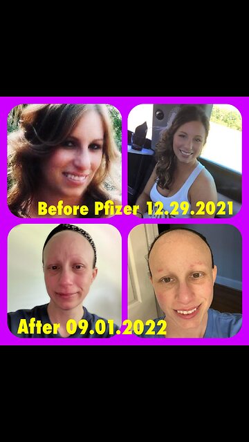 Lyndsey RN - vaxInjured Lounge host