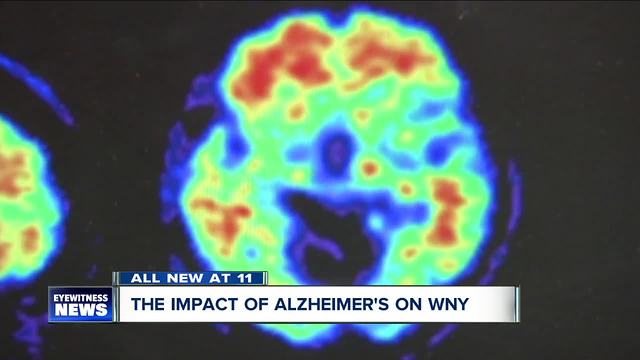 The impact of Alzheimer's on WNY