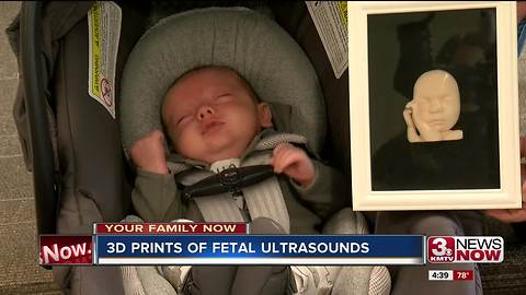 3D prints of fetal ultrasounds