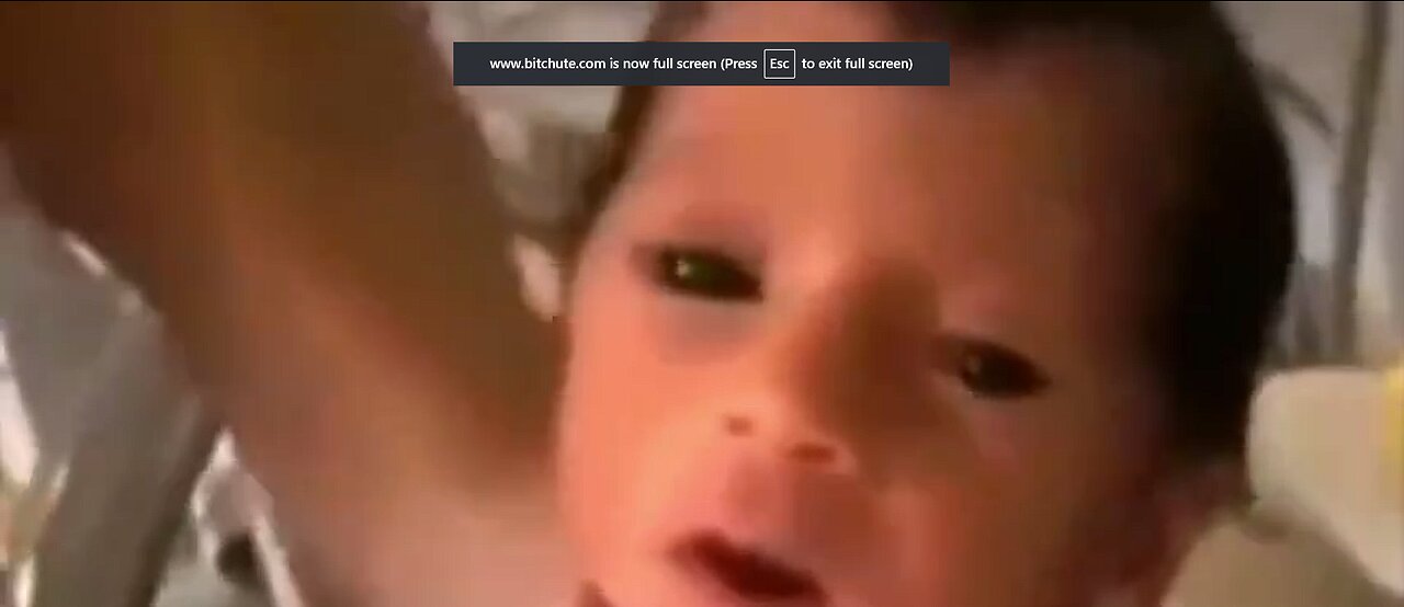 BLACK EYED PANDEMIC BABY COMPILATION