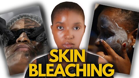 Why SO many people BLEACH THEIR SKIN